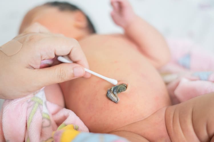 Umbilical cord of a newborn