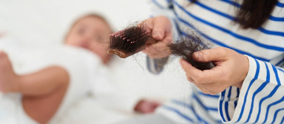 Hair loss after childbirth