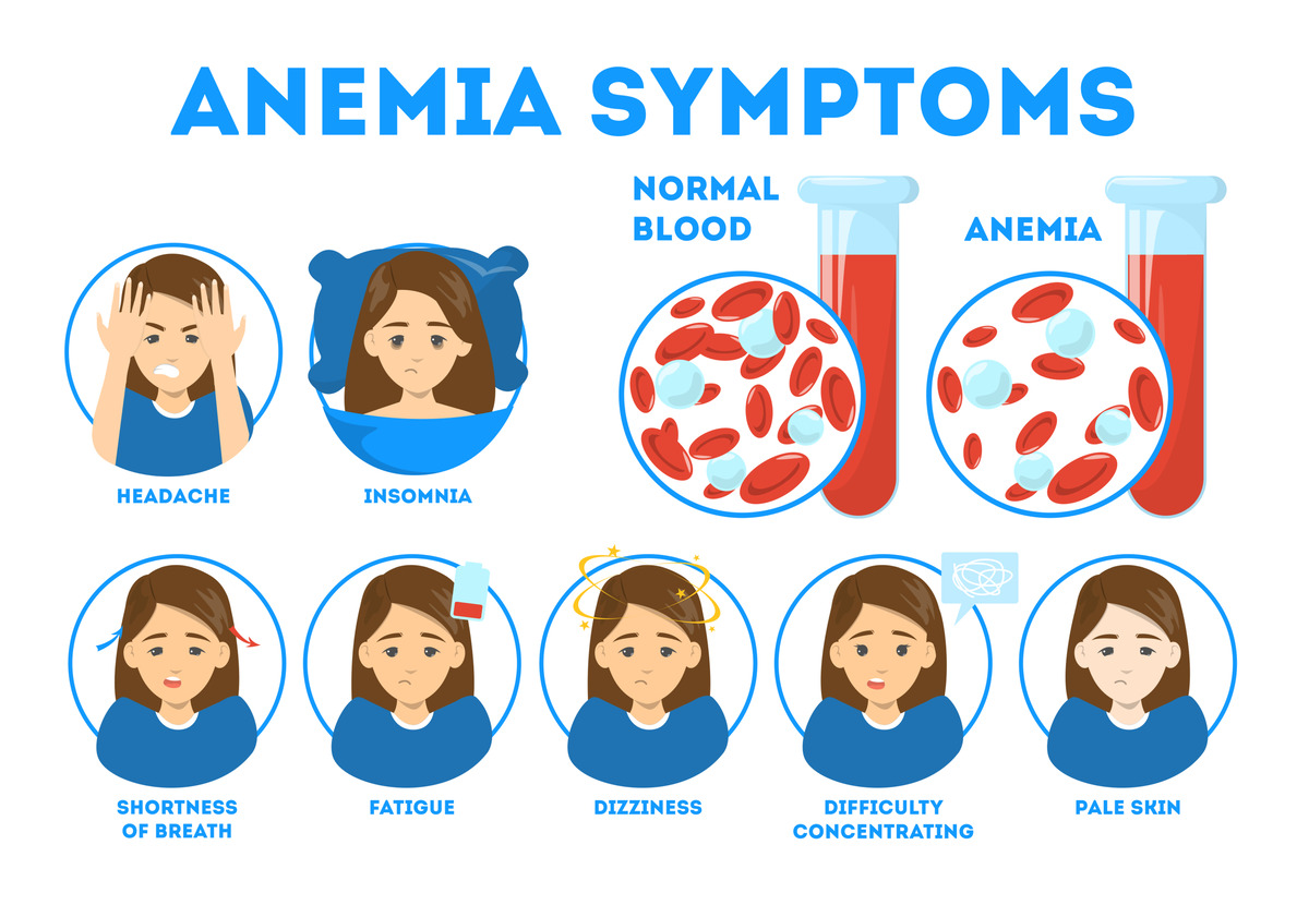 Anemia in pregnancy symptoms