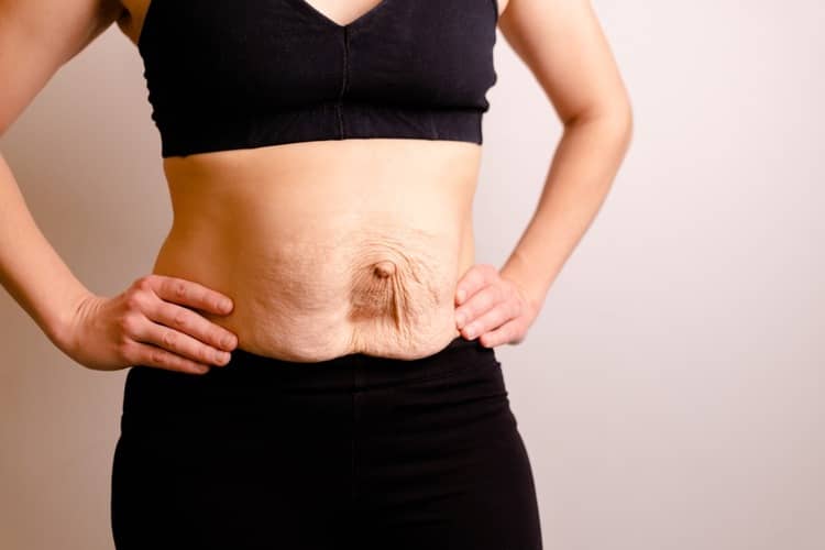 What is diastasis?