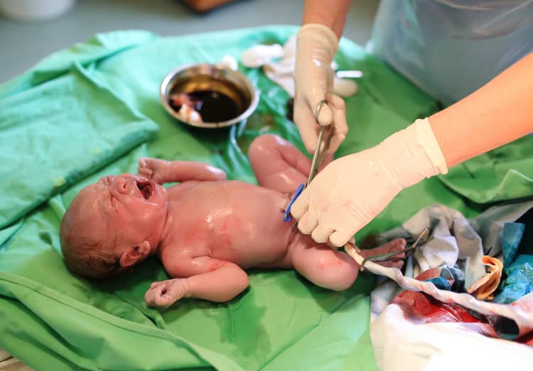 Cutting the umbilical cord