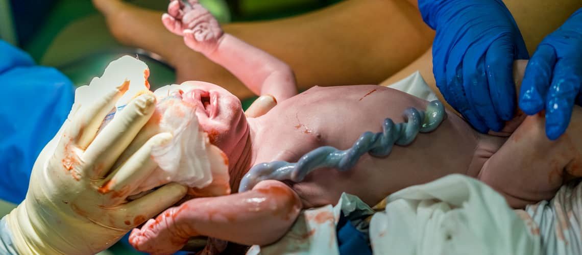 Umbilical cord