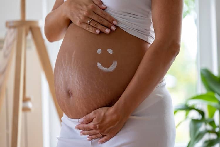 Stretch marks during pregnancy and after childbirth