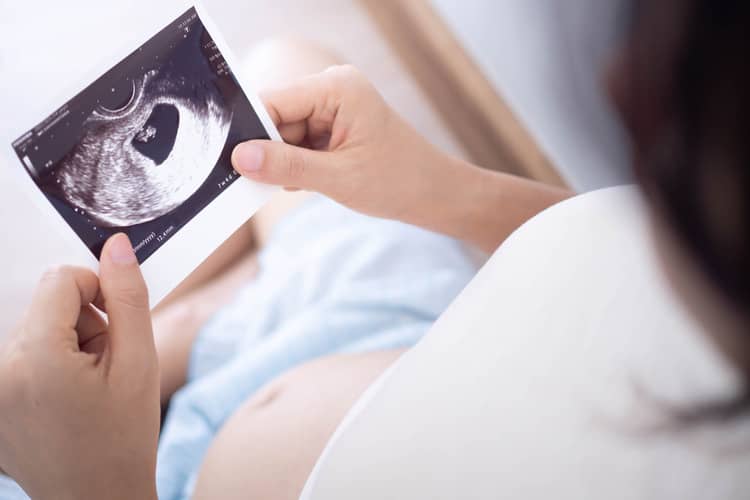 When is the first ultrasound done during pregnancy?