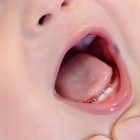 A child with growing teeth