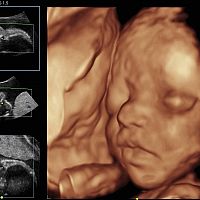 Fetal morphology