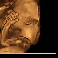 Morphological ultrasound 4D