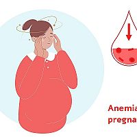 Anemia in pregnancy