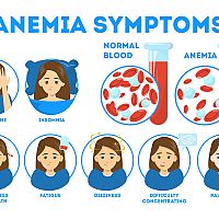 Anemia in pregnancy symptoms