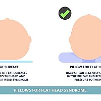 Pillow for flat head syndrome