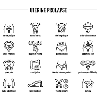 Uterine prolapse