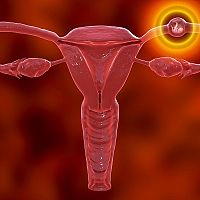 What is an ectopic pregnancy?